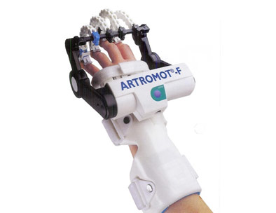 Motodlaha prstov vrátane palca ARTROMOT® F
