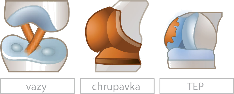 Voľba programu